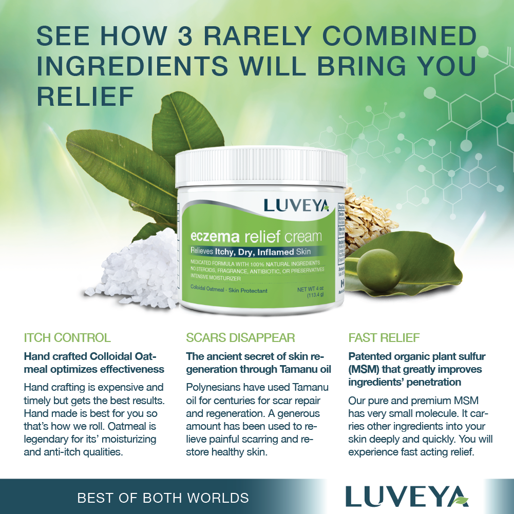 over the counter eczema cream