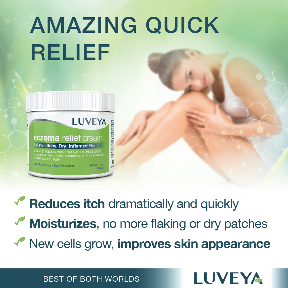 eczema creams over the counter