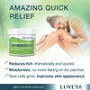 eczema creams over the counter